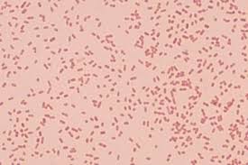 Klebsiella pneumoniae         Medicine Live